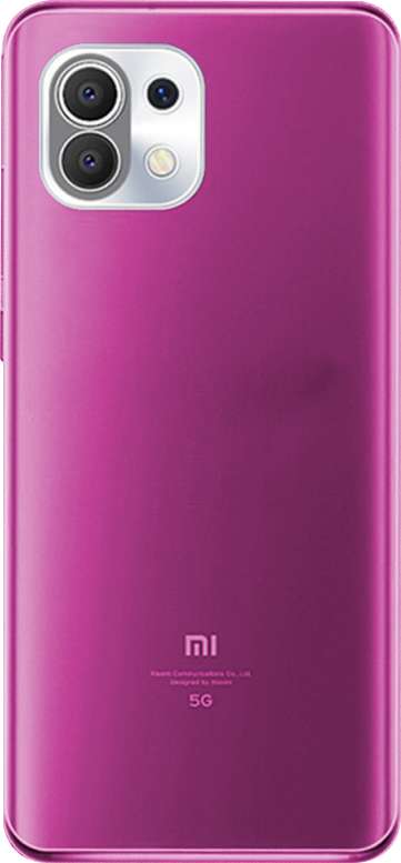 Funda Personalizada para Xiaomi Mi 11